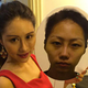 Image for article titled Intense Photos of Plastic Surgery Tranformations Going Viral in China